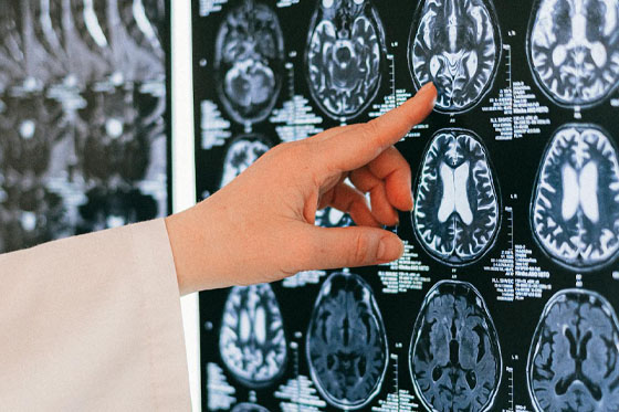 Brain MRI with content on GABA in young barley grass for neurological and metabolic health.